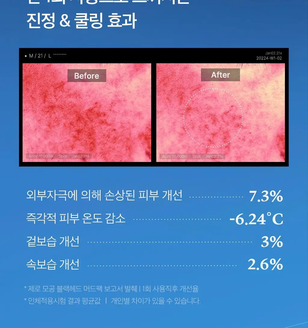 [3분모공청소]메디큐브 제로 모공 블랙헤드 머드팩 100g 상세페이지 33